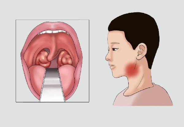 鸡肝不能和什么一同吃